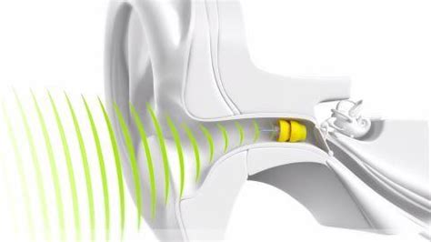 phonak lyric preisliste.